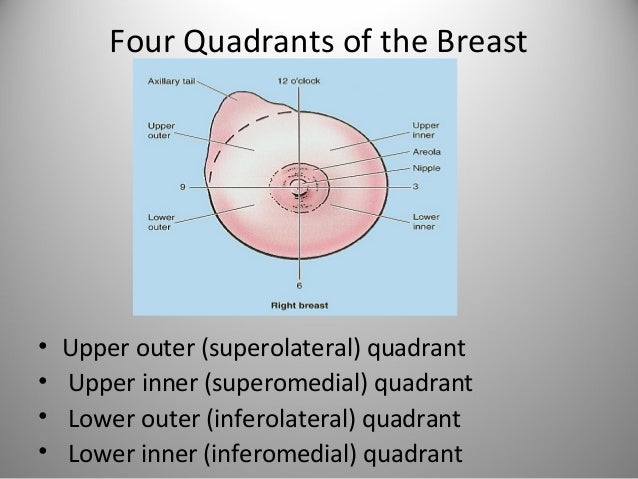 lump on upper breast Lump on upper breast